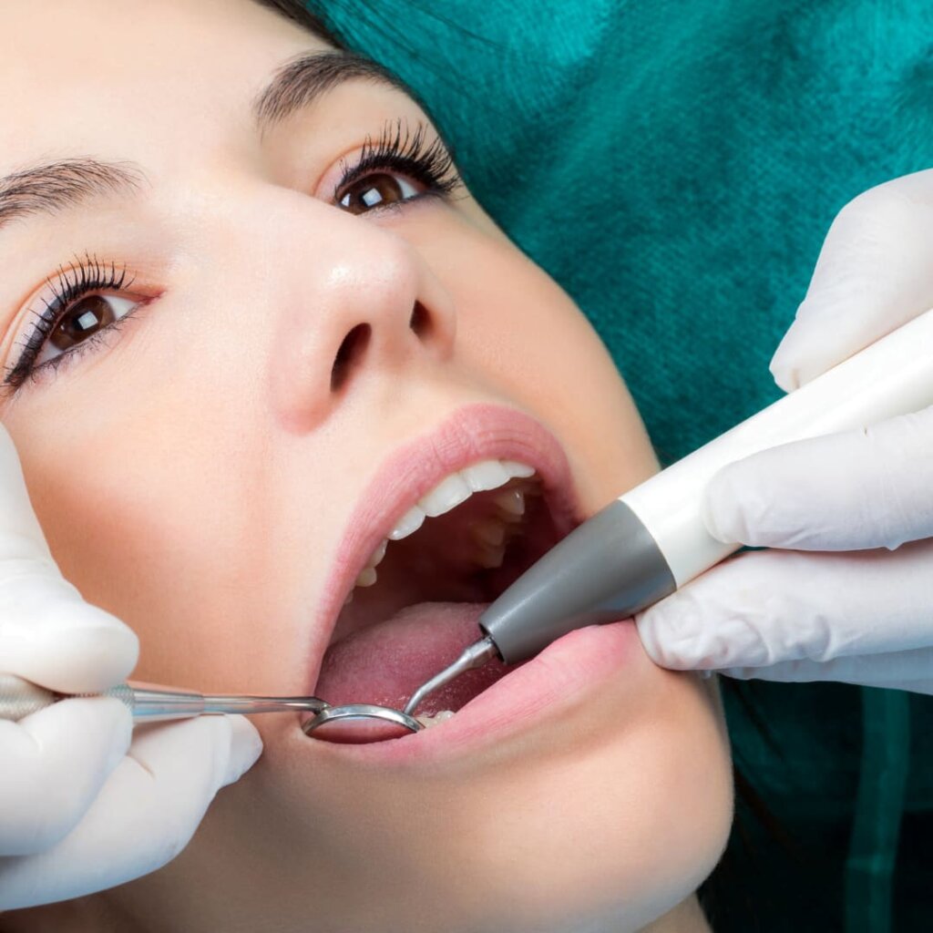 tartrectomia zaragoza