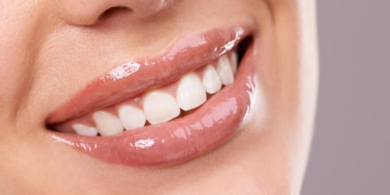 Cómo blanquear los dientes de forma natural: primer plano de una sonrisa con los dientes blancos y limpios