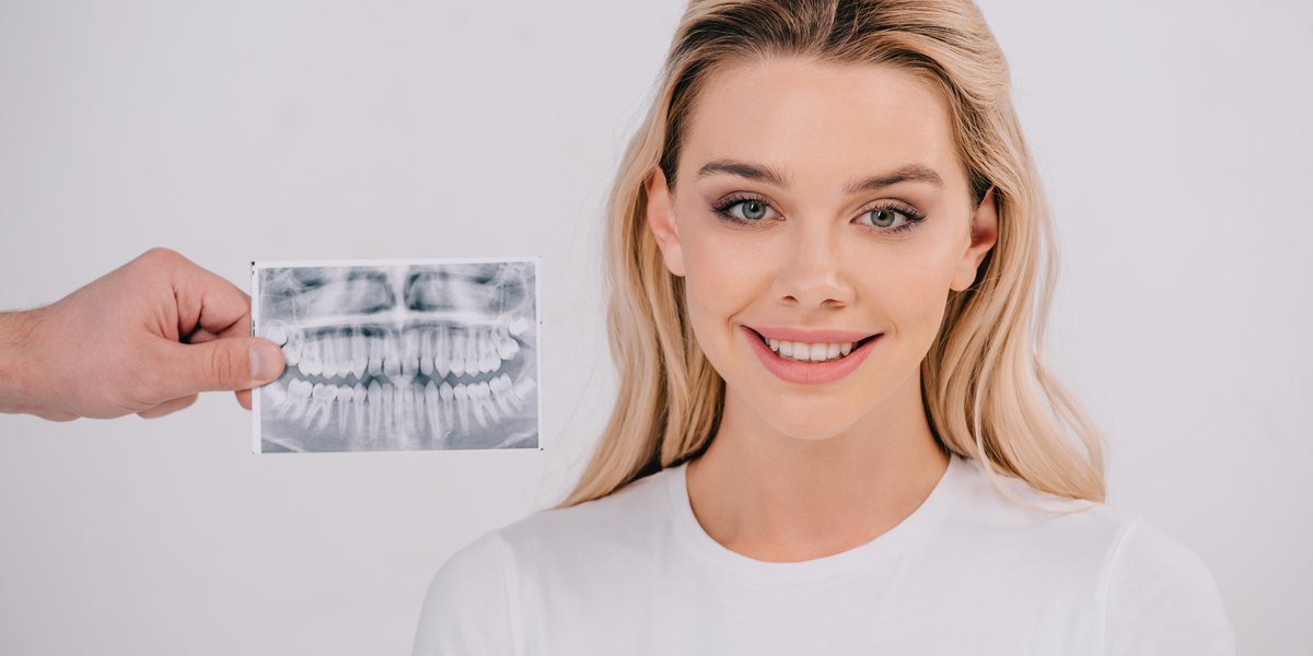 Radiografía dental: una mano sostiene una radiografía panorámica de la dentadura con dientes y raíces