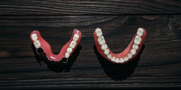 Dentadura postiza sin paladar: cuándo es posible y qué opciones hay