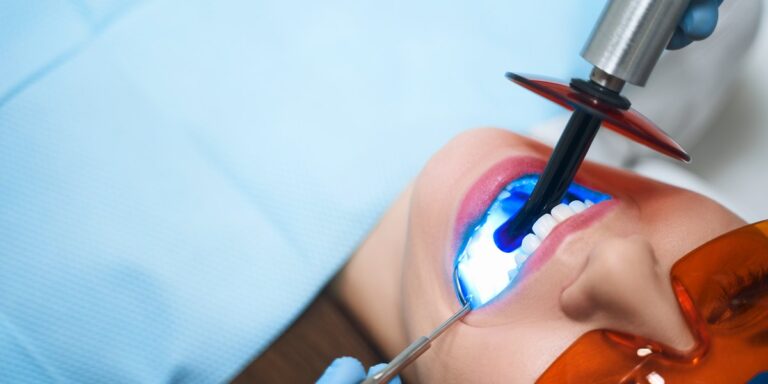 Diente roto: el dentista endurece con la lámpara de luz azul una reconstrucción de resina