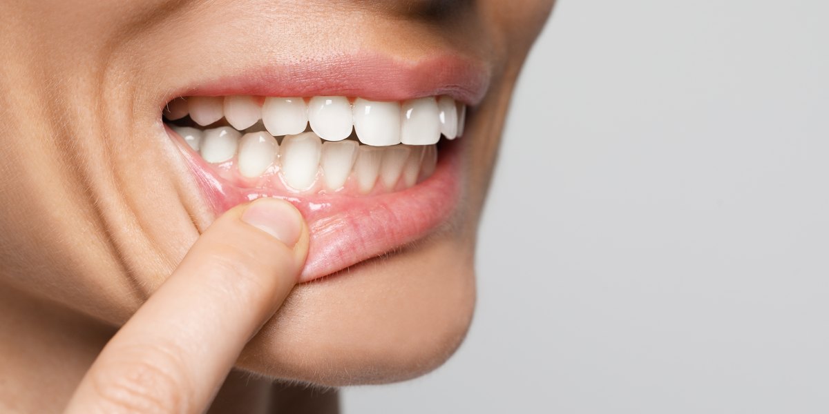Encías negras: una mujer se baja el labio inferior y enseña unas encías rosadas y sanas