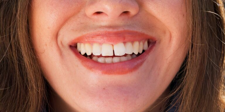 Esmalte dental: qué es, por qué se desgasta y si se puede regenerar