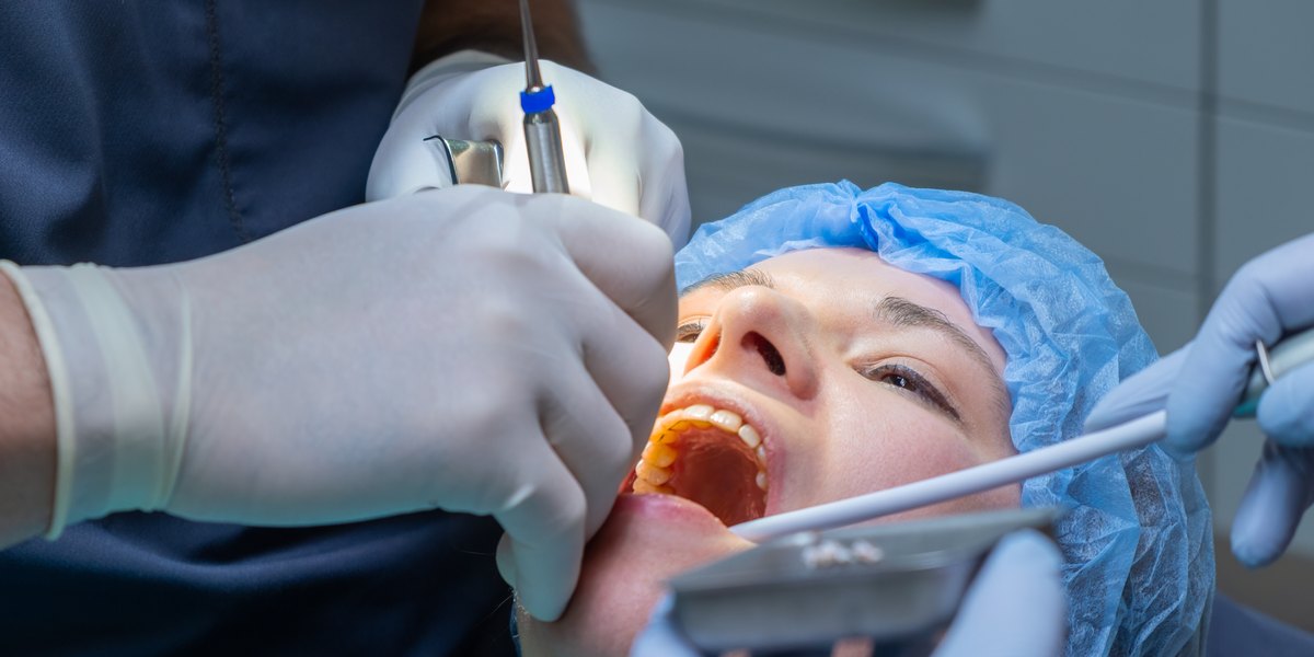 Exodoncia: el dentista trabaja con guantes sobre la boca abierta de una paciente con gorro quirúrgico mientras la asistente aspira
