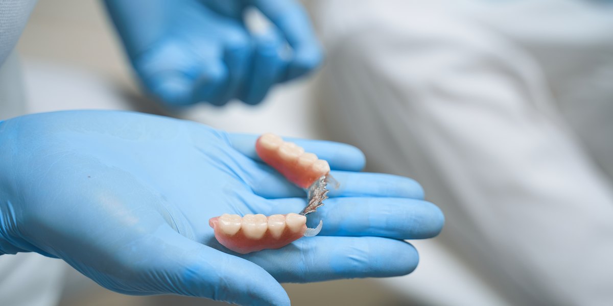 Esquelético dental: la mano enguantada del dentista sostiene una prótesis esquelética inferior con dos tramos de dientes unidos por una barra metálica