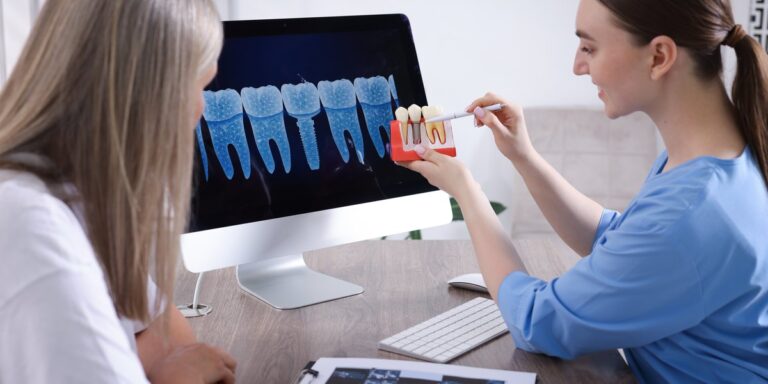Síntomas de rechazo de implantes dentales: causas y qué hacer si se mueve